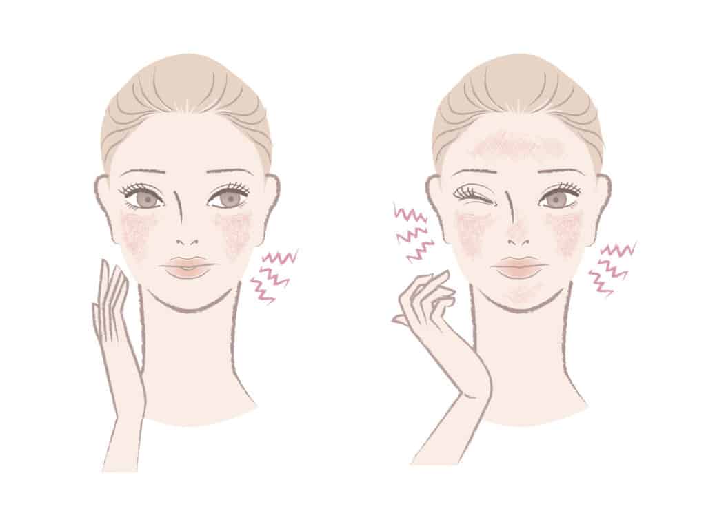 How To Tell If You Have Sensitive Skin Type