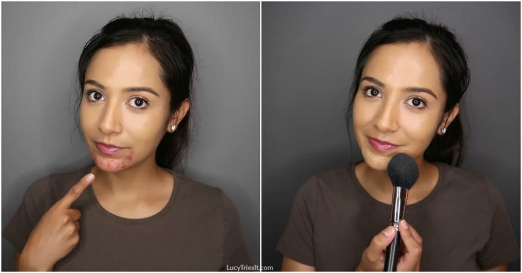 Cover cystic acne with makeup
