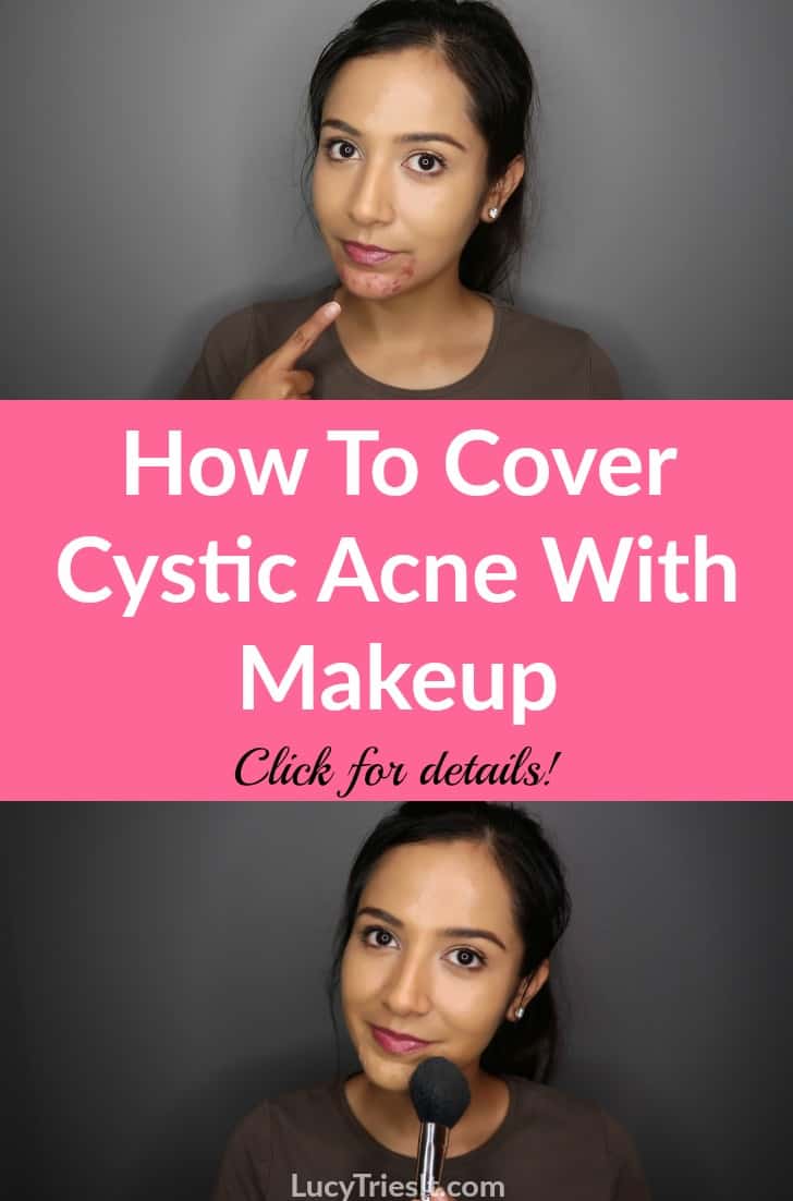 Cystic acne can be very frustrating. Luckily, there is an effective way to cover cystic acne with makeup and I'm going to show you how!