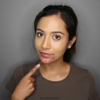 How To Cover Cystic Acne With Makeup
